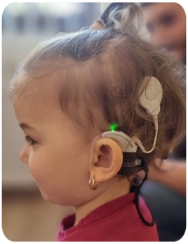 Kind Cochlea Implantat Soundprozessor